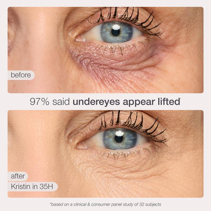 Stop Looking Tired. Start Looking Yourself.